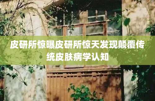 皮研所惊曝皮研所惊天发现颠覆传统皮肤病学认知