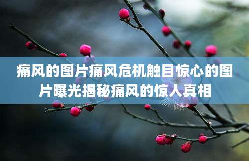 痛风的图片痛风危机触目惊心的图片曝光揭秘痛风的惊人真相