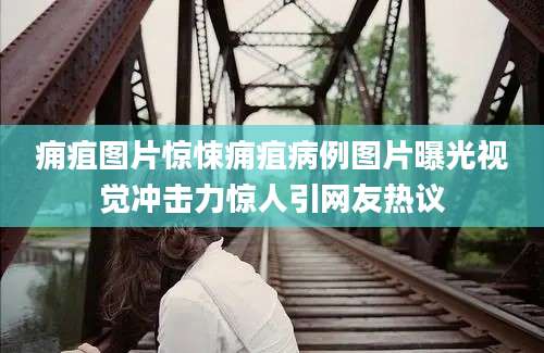 痈疽图片惊悚痈疽病例图片曝光视觉冲击力惊人引网友热议